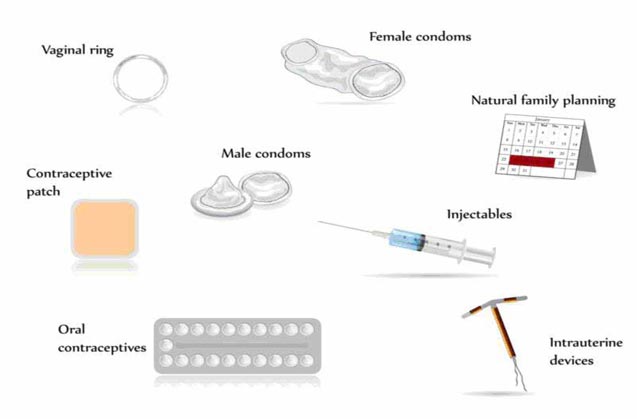 انواع روش های جلوگیری از بارداری