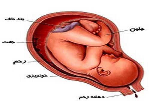 چرا خانم باردار خونریزی می‌کند؟ 