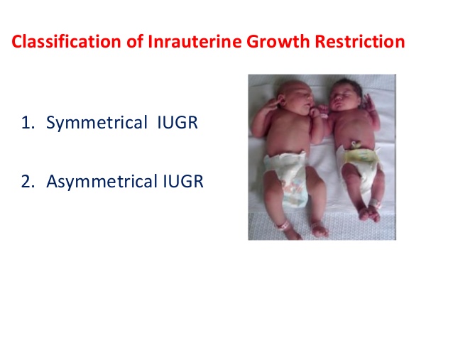 محدودیت رشد داخل رحمی ( IUGR)