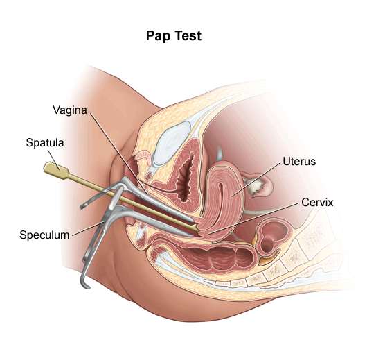  تست غربالگری سرطان دهانه ی رحم پاپ اسمیر