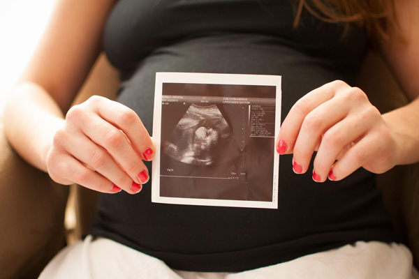 سونوگرافی‌های معمول و موارد خاص در دوران بارداری