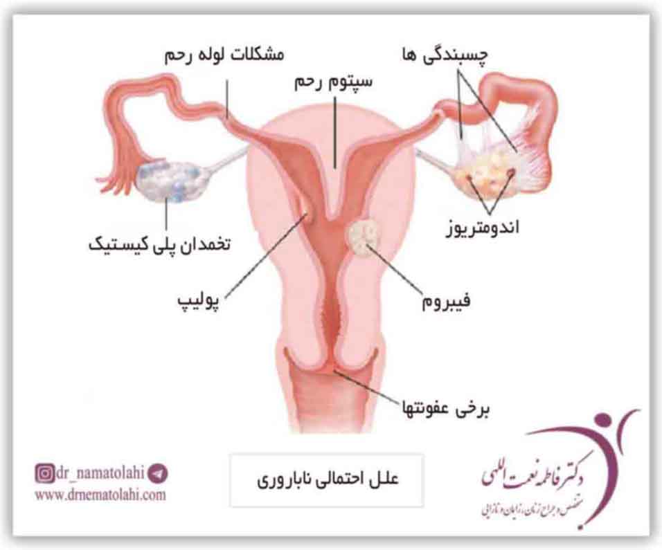 علل احتمالی ناباروری