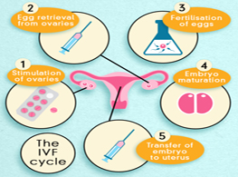 روش های نوین باروری: لقاح مصنوعی (IVF/Microinjection)